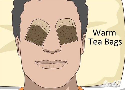 استفاده از چای کیسه ای برای کاهش پف چشم و صورت