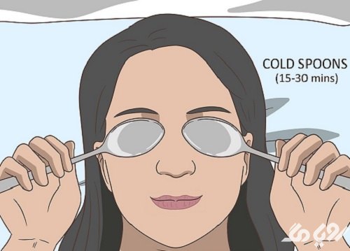 کاهش پف چشم با قاشق سرد
